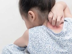 Psychosomatische oorzaken van psoriasis bij kinderen en volwassenen