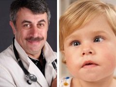 Dr. Komarovsky sobre el estrabismo en niños.