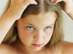 Dandruff psychosomatics in children and adults