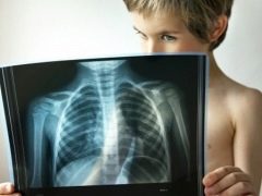 Psychosomatics of lung problems in children and adults