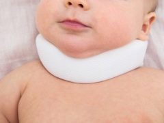 Signs and symptoms of torticollis in newborns and infants