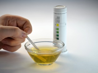 Determinarea benzilor de test pentru glucoza din urină