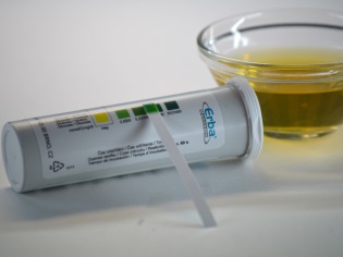 Determinarea benzilor de test pentru glucoza din urină