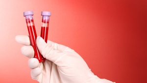 Esame del sangue sierologico per epatite, HIV, sifilide e altre malattie