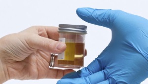 Urine analysis in children