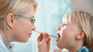 Behandeling van herpes-stomatitis bij een kind