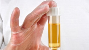 Mucus in the urine of a child