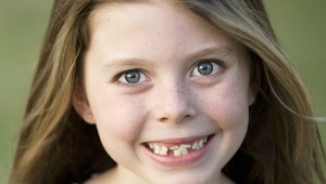 Curved teeth in children