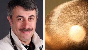 Dr. Komarovsky about the causes of hair loss in children