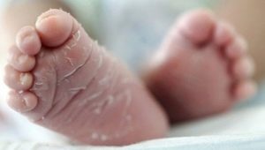 Perché un bambino ha la pelle secca e cosa fare?