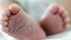 What to do if the skin of a newborn is flaky?