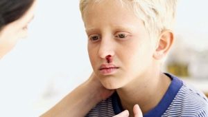 Thrombocytopenische purpura bij kinderen