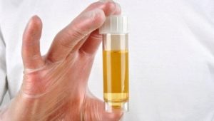 Protein in the urine during pregnancy: norms and causes of deviations