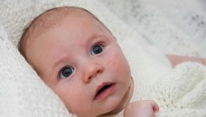 How to distinguish between heat loss and allergies in infants?