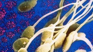 Come sono disposti gli spermatozoi? Le loro caratteristiche, struttura, dimensioni e funzionalità