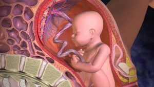 ¿Cómo se ve la placenta y dónde está unida?