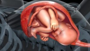 Tipos de unión del cordón umbilical a la placenta: normas y riesgo de desviaciones