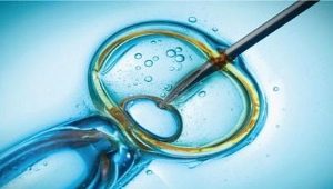 What is ICSI - intracytoplasmic sperm injection, how is the procedure?