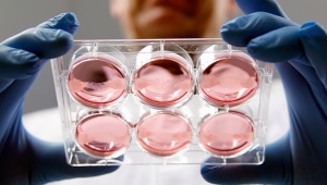 Trasferimento di embrioni in IVF: caratteristiche e sensazioni dopo la procedura