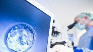 Protocollo lungo di IVF di giorno: schema e descrizione