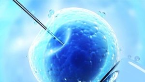 Protocollo di IVF breve di giorno: schema e descrizione