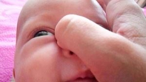 Massage of the lacrimal canal for newborns and infants