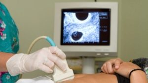 When does the fetus's heart begin to beat? When can you hear a heartbeat or see it on an ultrasound?