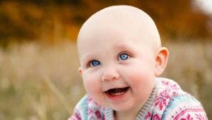 Alopecia en niños: causas y métodos de tratamiento.