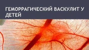 Vasculitis hemorrágica en niños: de los síntomas al tratamiento