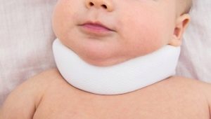 Signs and symptoms of torticollis in newborns and infants