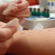 Allergy tests for children and their types