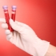 Serological blood test for hepatitis, HIV, syphilis and other diseases