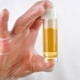 Protein in the urine of a child