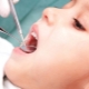 Estomatitis en el lenguaje de los niños.