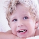 Bruxism: baby grind his teeth