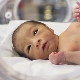 Pneumonia in premature babies