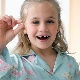 Removal of milk and molars in children