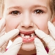 Frequent problems with gums in children