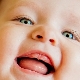 Swollen gums in infants