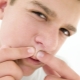 How to treat teen acne in boys?