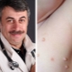 Dr. Komarovsky over de behandeling van kinderen met molluscum contagiosum