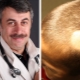 Dr. Komarovsky sulle cause della perdita di capelli nei bambini