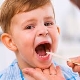 What does the throat of a child with pharyngitis look like?