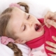 Symptoms and treatment of laryngitis in children