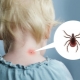 What to do if a child has been bitten by a tick?