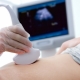 What is screening during pregnancy and how is it done?