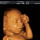 4D ultrasound during pregnancy