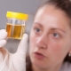 Terms of delivery of urine analysis during pregnancy