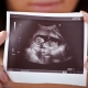 Ultrasound in the 20th week of pregnancy: fetal size and other features