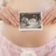 Ultrasound in the 30th week of pregnancy: fetal size and other features